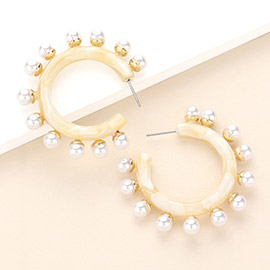 Peal Embellished Acetate Hoop Earrings